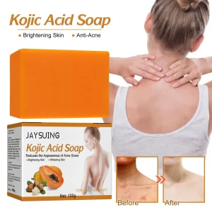 K Acid Skin Lightening Soap